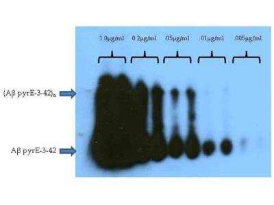 Western Blot: beta Amyloid [Pyro Glu3] Antibody [NBP1-44048]